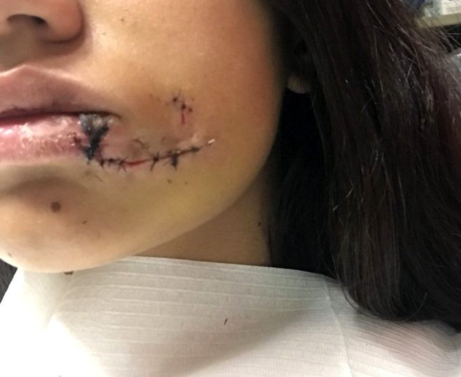 İtlə şəkil  çəkdirmək istədi, üzünə 40 tikiş vuruldu - FOTOLAR